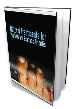 Natural Treatments for Psoriasis and Psoriatic Arthritis (image for) Natural Treatments for Psoriasis and Psoriatic Arthritis